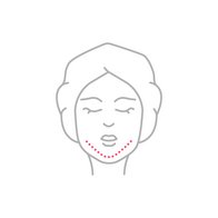 20240131_Biolitec_Lipolyse_Icon_Kinn